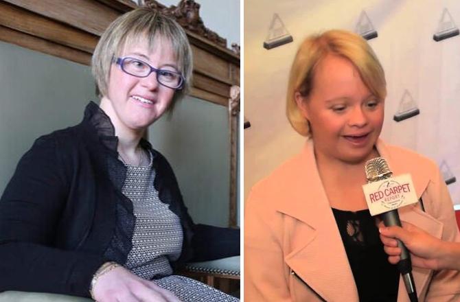 These women suffering from Down syndrome are making their mark all over the world today. Photo: INN