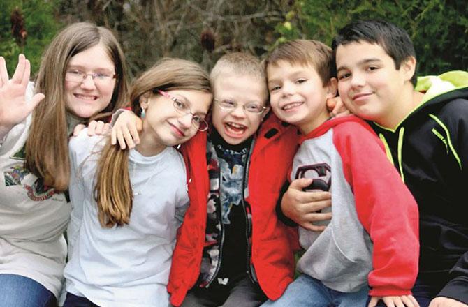 These children look identical because of the extra copy of chromosome 21. Photo: INN